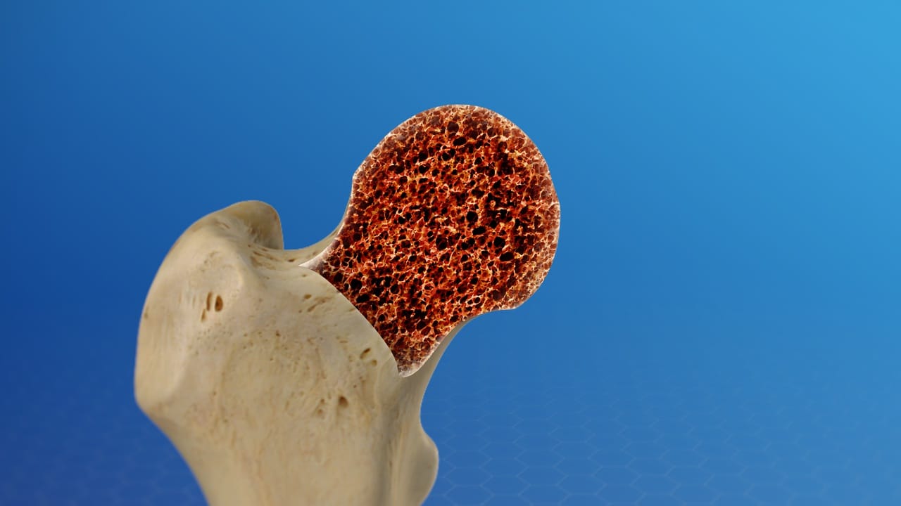 Genex Steroids and Bone Density